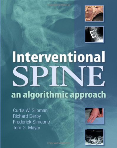 Interventional Spine An Algorithmic Approach