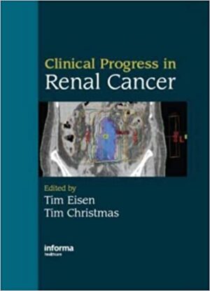 Clinical Progress in Renal Cancer