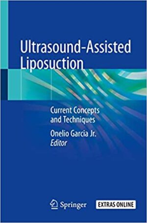Ultrasound Assisted Liposuction Current Concepts and Techniques