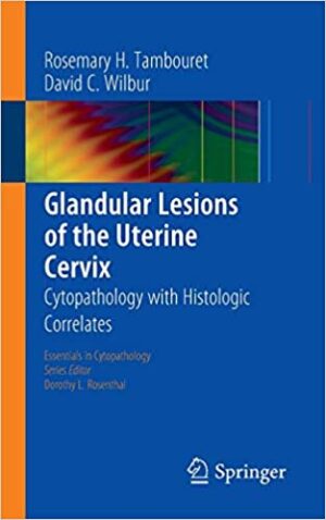 Glandular Lesions of the Uterine Cervix Cytopathology with Histologic Correlates