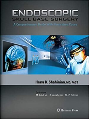 Endoscopic Skull Base Surgery A Comprehensive Guide with Illustrative Cases