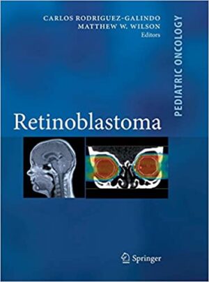 Retinoblastoma By Carlos Rodriguez Galindo