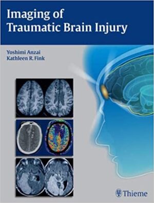 Imaging of Traumatic Brain Injury