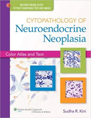 Cytopathology of Neuroendocrine Neoplasia Color Atlas and Text