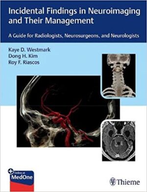 Incidental Findings in Neuroimaging and Their Management A Guide for Radiologists Neurosurgeons and Neurologists