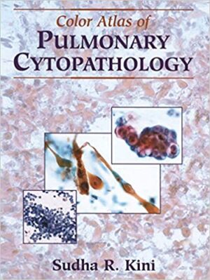 Color Atlas of Pulmonary Cytopathology
