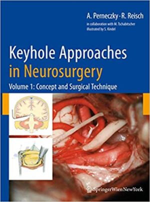 Keyhole Approaches in Neurosurgery Volume 1 Concept and Surgical Technique