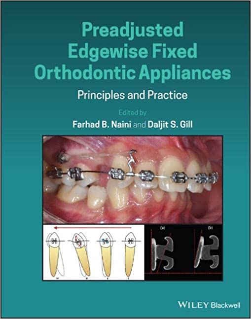 Preadjusted Edgewise Fixed Orthodontic Appliances Principles and Practice