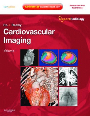 Cardiovascular Imaging